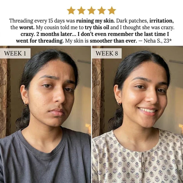 Layali Follicle Rotundus Oil for Hair Removal |🔥Buy 1 Get 1 Free🔥