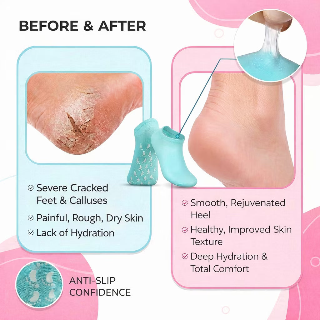 Heel Healing Therapy Gel Socks | 🔥FLAT 50% SAVINGS🔥