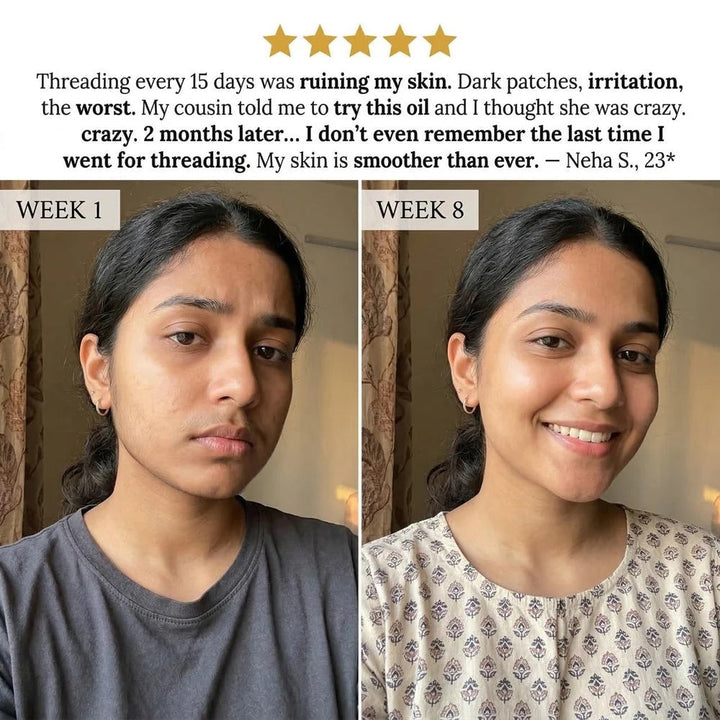 Layali Follicle Rotundus Oil for Hair Removal |🔥Buy 1 Get 1 Free🔥🔥