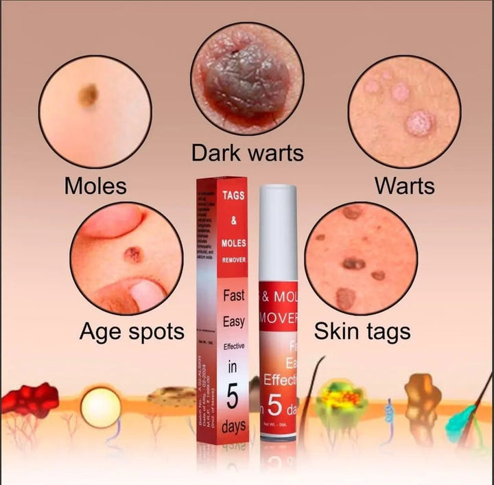 TagMo™ - Tags &amp; Moles Remover (Buy 1 Get 1 Free🔥🔥)